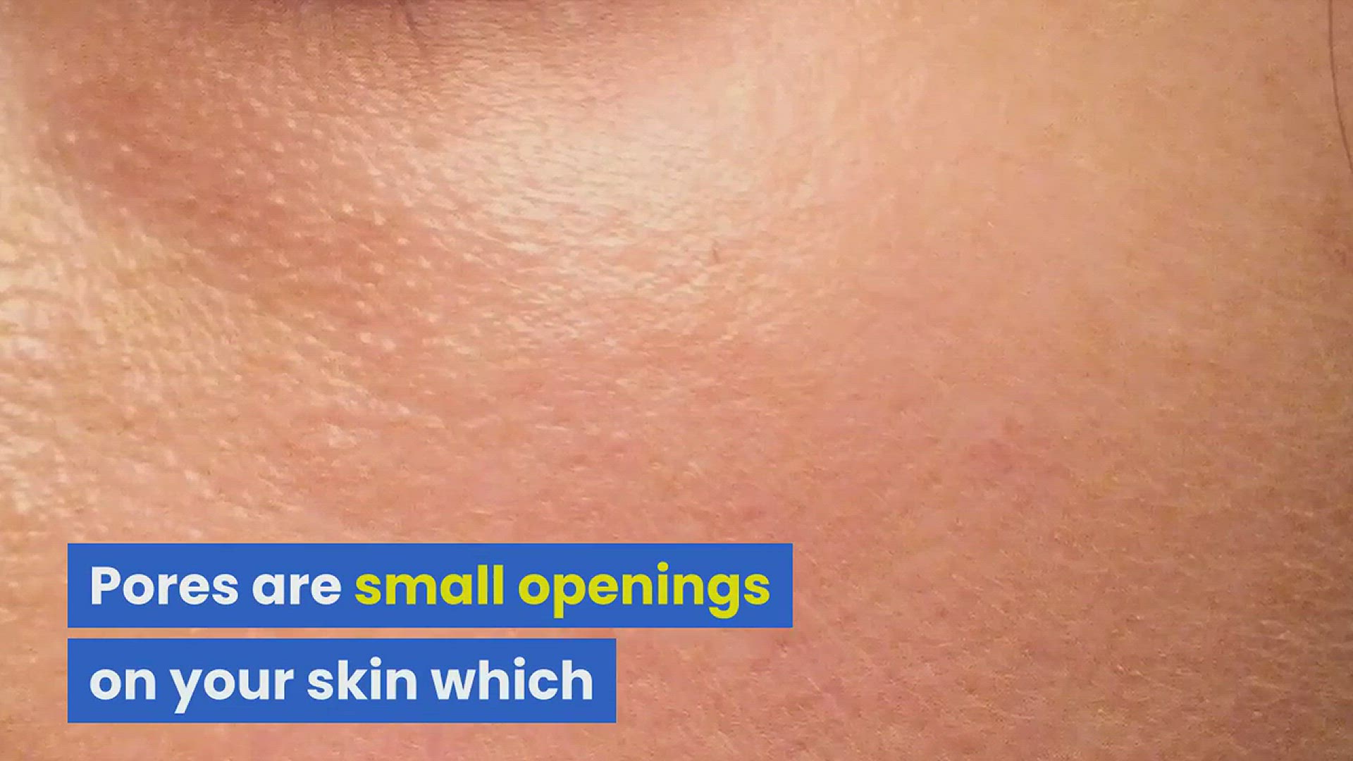 'Video thumbnail for What Causes Large Pores'