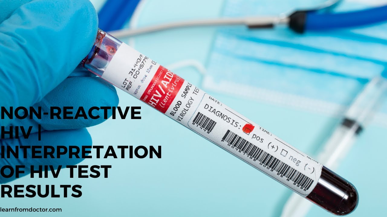 Non Reactive Hiv Interpretation Of Hiv Test Results